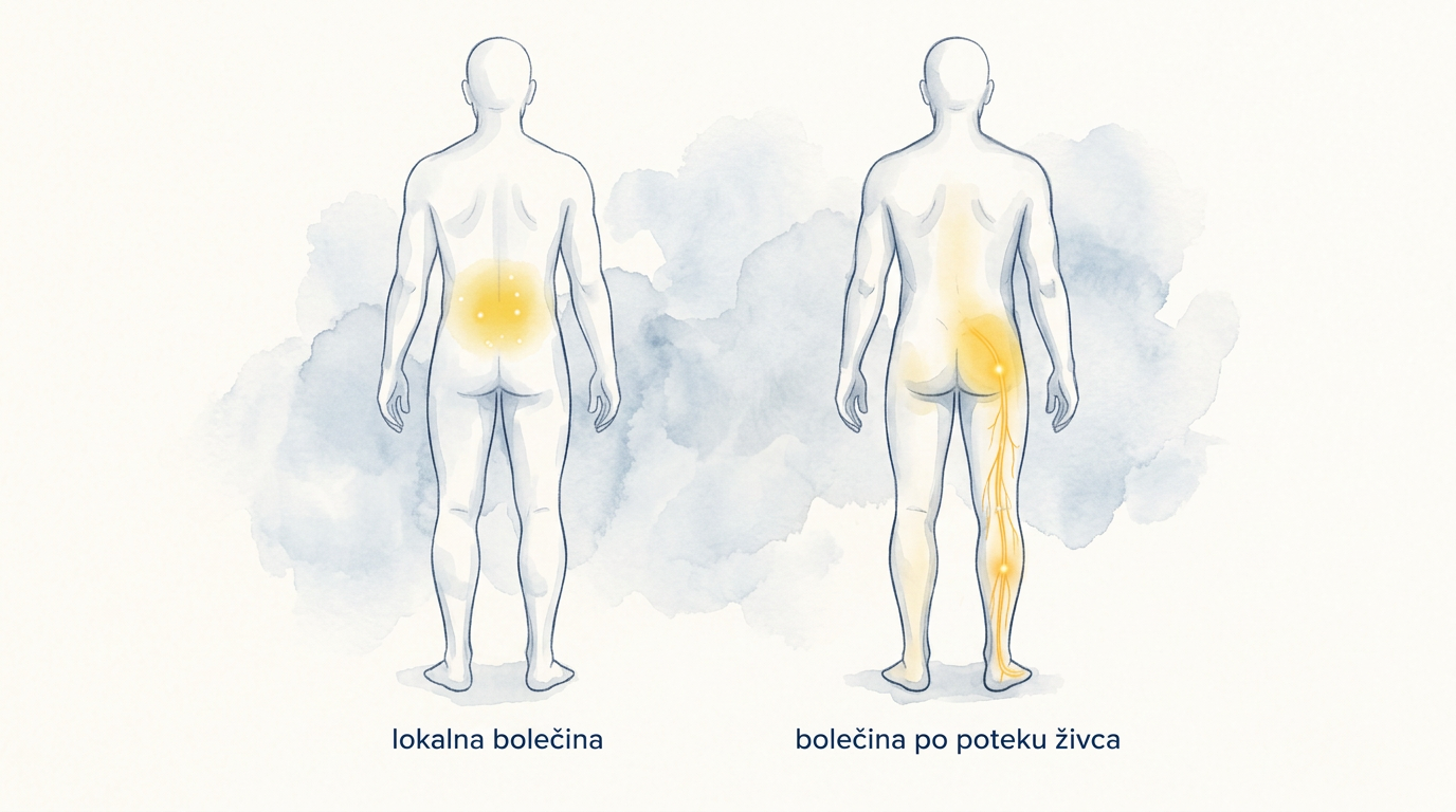 Primerjava lokalne bolečine v križu in radikularne bolečine, ki se širi po poteku živca v nogo