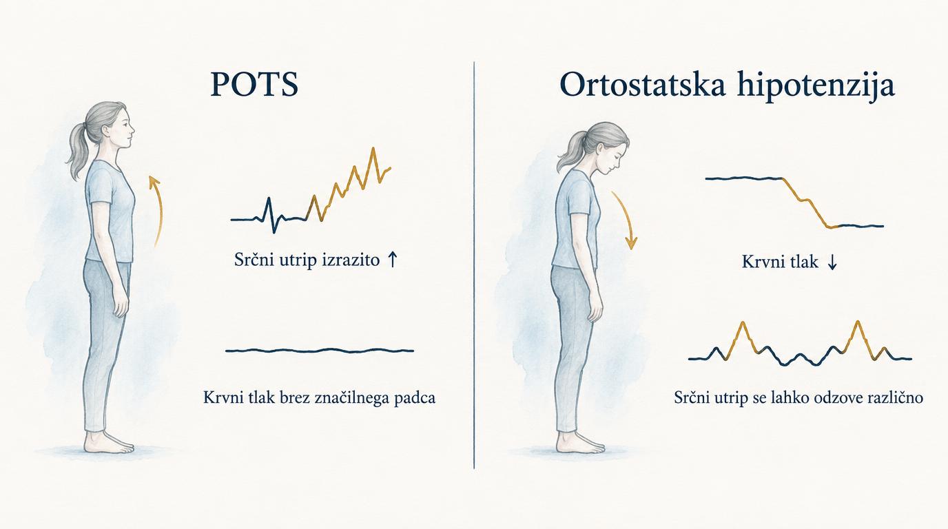 Primerjava POTS z izrazitim porastom srčnega utripa in ortostatske hipotenzije s padcem krvnega tlaka